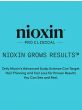 Nioxin System 3 Kit for Colored, Light Thinning Hair | Hair Thickening Shampoo, Conditioner, & Treatment | Large Size