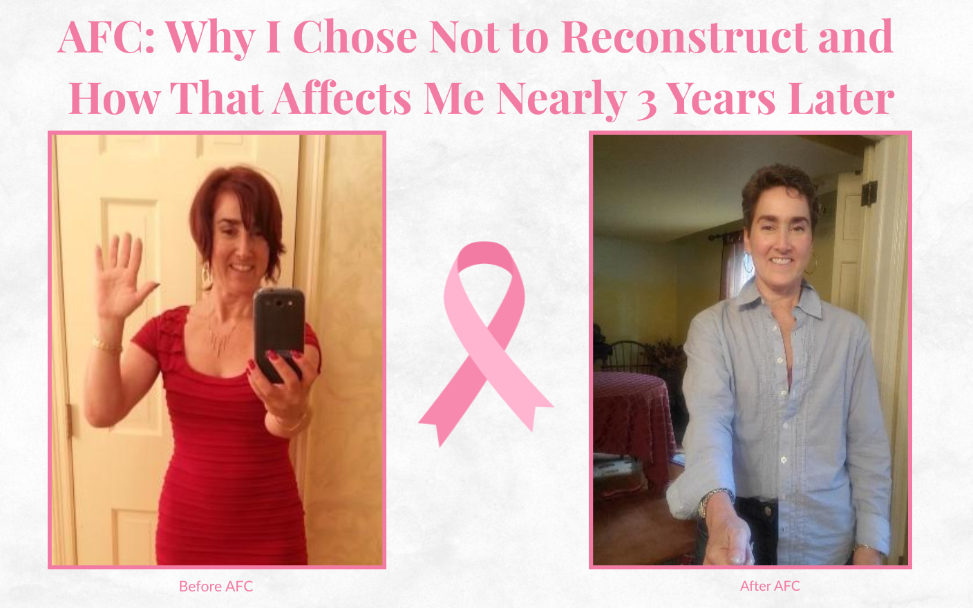 Why I Chose Not to Reconstruct After Breast Cancer