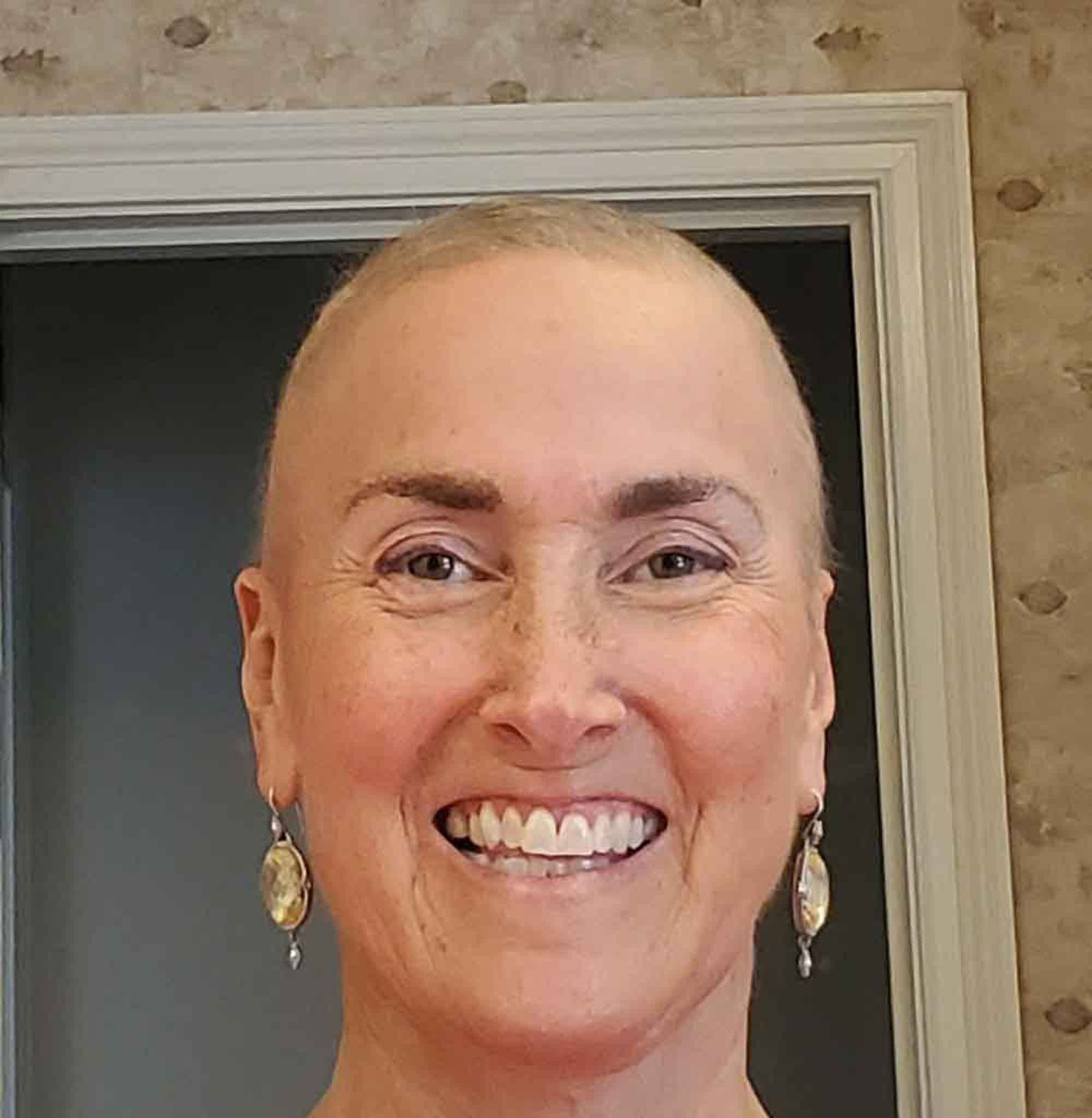 how-much-the-seasons-affect-headwear-choices-during-chemotherapy